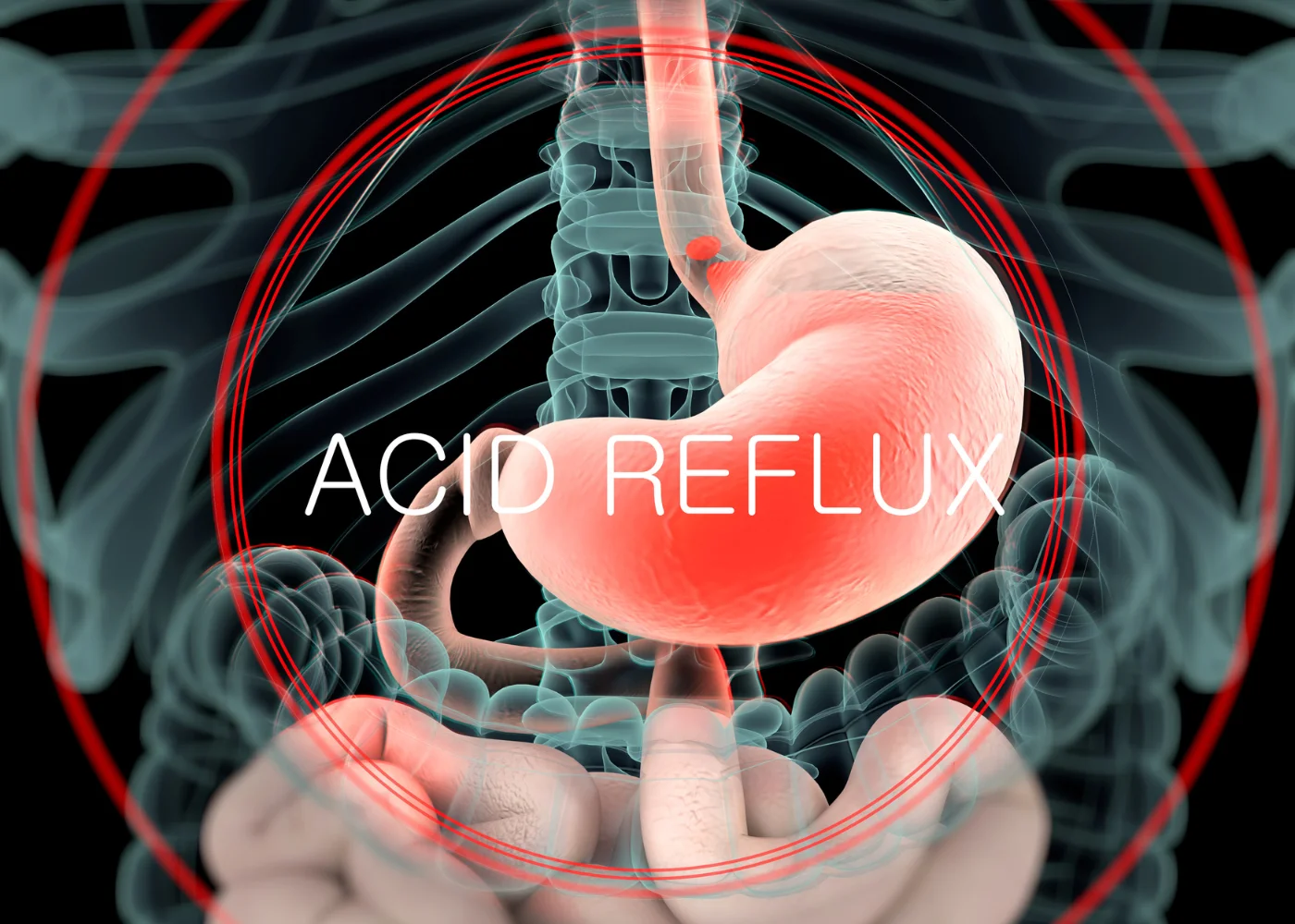 Ansia e reflusso gastroesofageo sintomi e rimedi