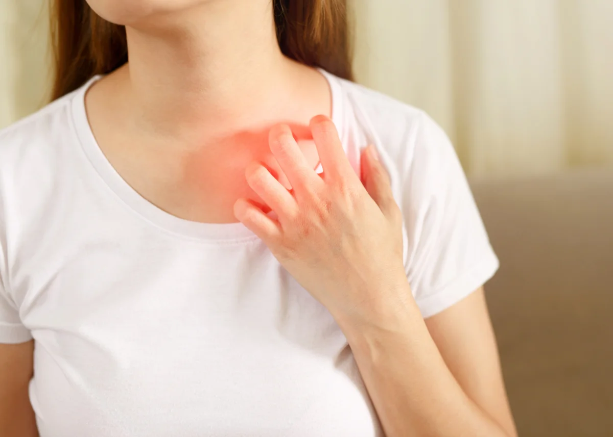 Orticaria da stress e ansia rimedi